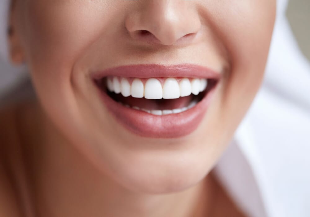 https://www.smilepartners.it/wp-content/uploads/2019/11/sbiancamento2.jpg