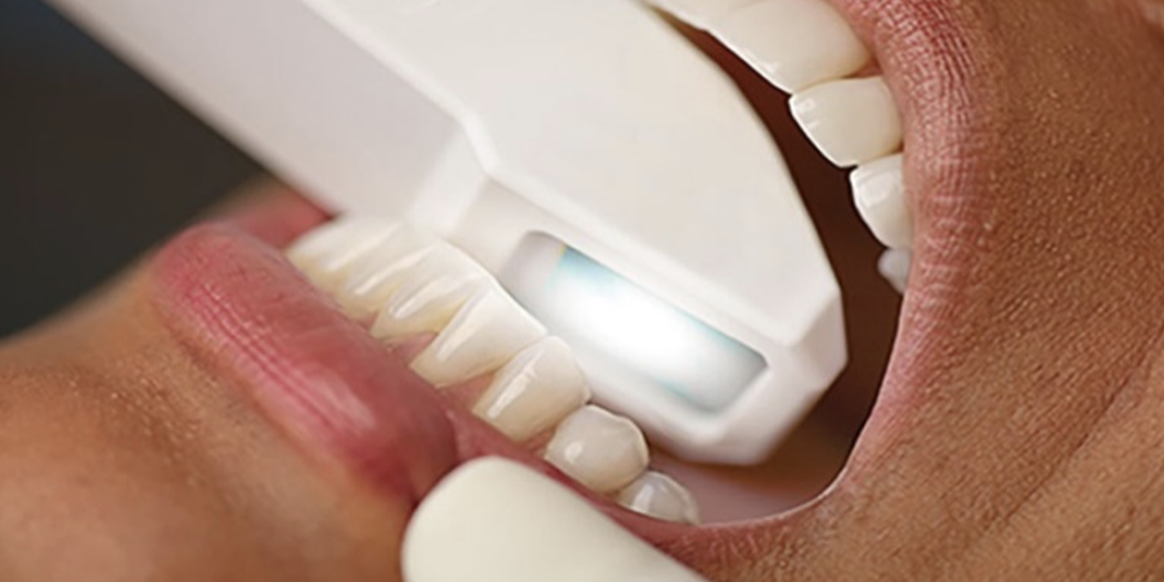 cosa sapere sull’estrazione di un dente