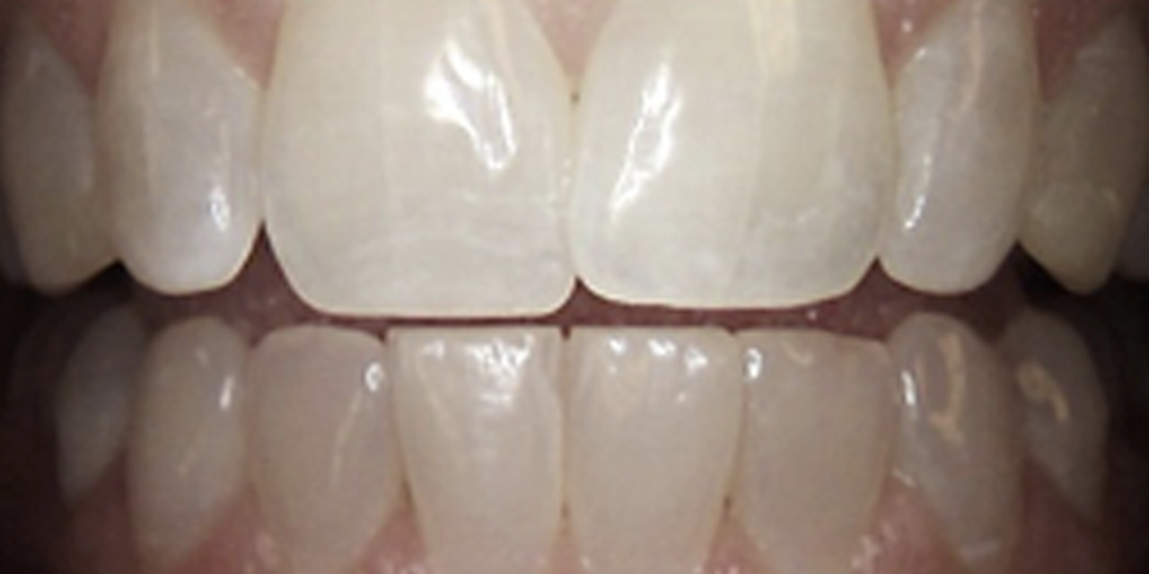 Terapie dentali