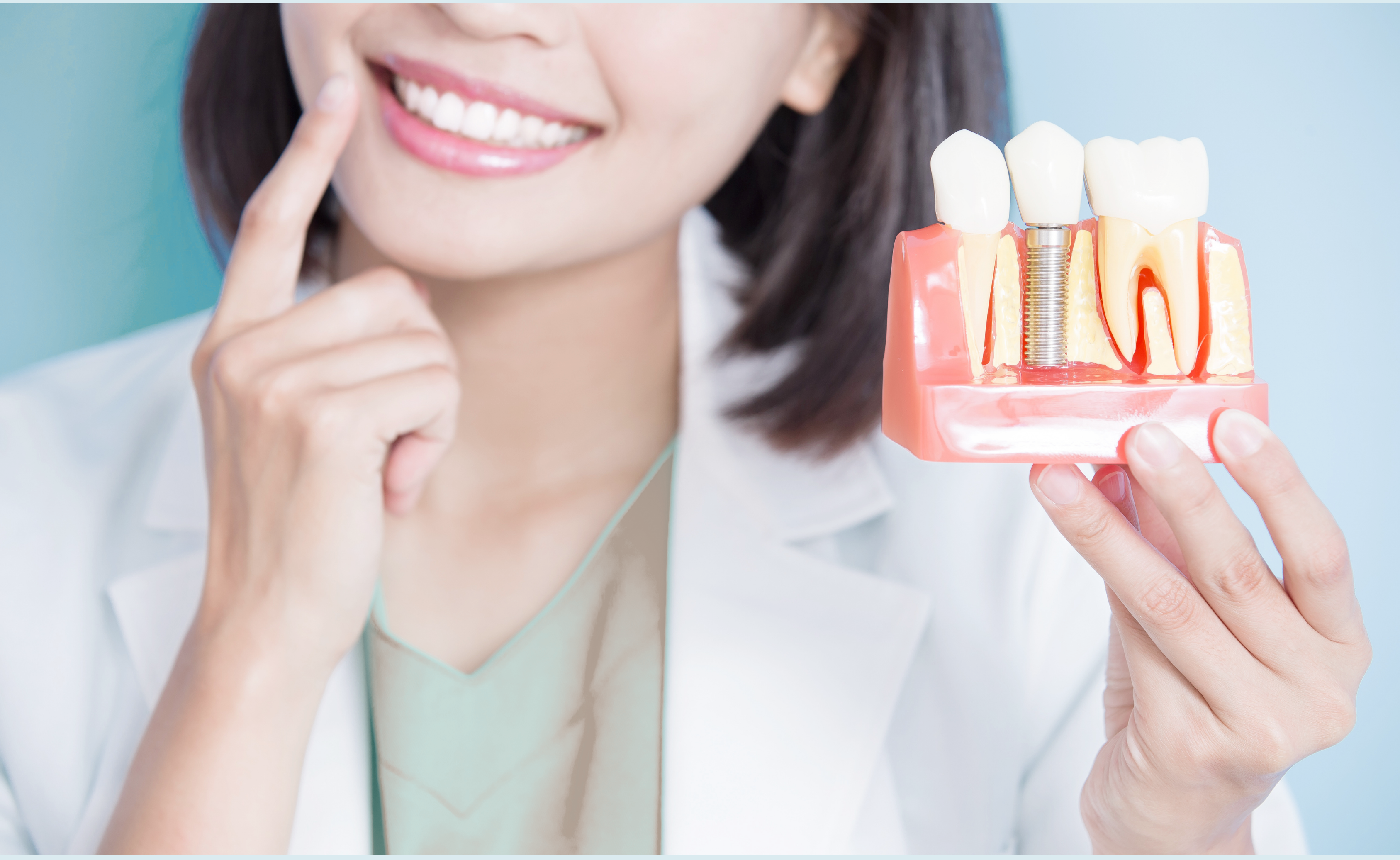 https://www.smilepartners.it/wp-content/uploads/2024/05/impianti-dentali-copia.png