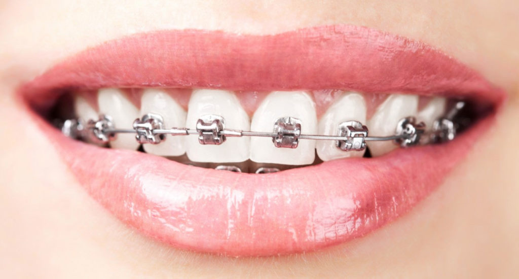https://www.smilepartners.it/wp-content/uploads/2024/10/ortodonto.jpg