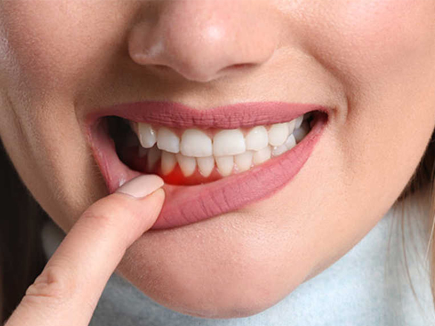 https://www.smilepartners.it/wp-content/uploads/2024/10/parodonto2.jpg